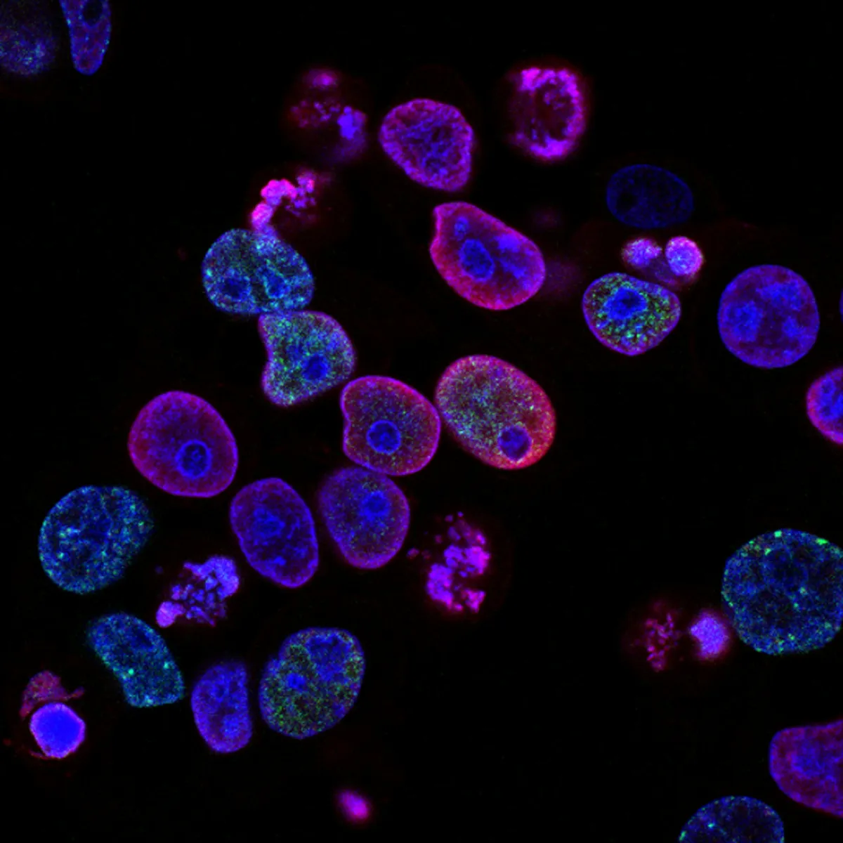 Breast Cancer Detection using Histology Images